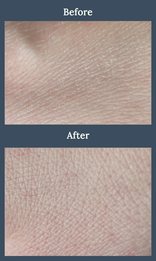 collagen-serum-before-after